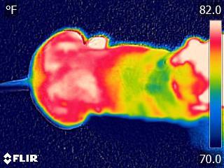 Thermographic image showing the inflammation or heat over the muscles of the lower back. In the image Blue is cool and White is warm.