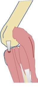 Digital Muscles of the Dog's Rear Limb